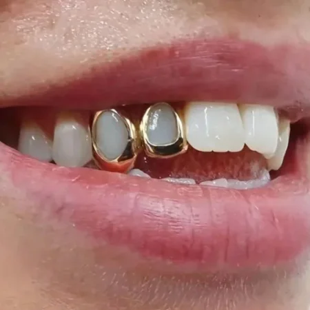 Hip Hop Hollow Double Teeth Grillz Punk 14K Gold Plated Tooth Caps Decor Braces Dental Grills For Women Men Jewelry