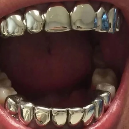 RACHELZ Hot Sale 8/8 Glossy Teeth Grillz Braces Hip Hop Gold Color Tooth Caps Decor For Women Men Jewelry
